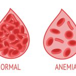 Kondisi Anemia Yang Di Alami Seseorang Akibat Kurang Darah