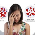 Kondisi Seorang Anemia Memiliki Beberapa Dampak