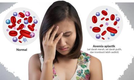 Kondisi Seorang Anemia Memiliki Beberapa Dampak