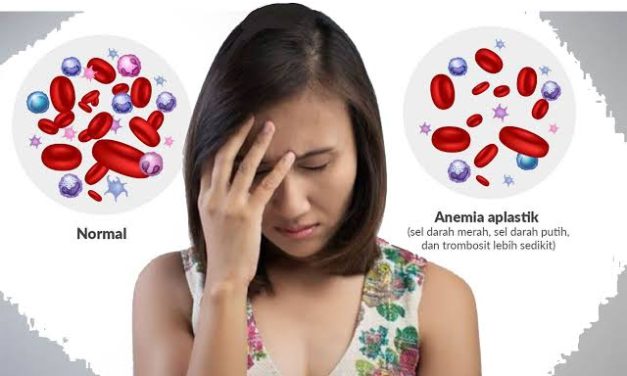 Kondisi Seorang Anemia Memiliki Beberapa Dampak
